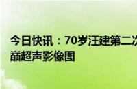 今日快讯：70岁汪建第二次登顶珠峰，华大完成首张世界之巅超声影像图