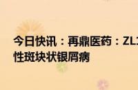 今日快讯：再鼎医药：ZL1102尚未在国内获批用于治疗慢性斑块状银屑病