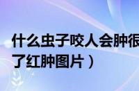 什么虫子咬人会肿很大的包还很痒（被虫子咬了红肿图片）