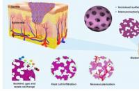 多孔纳米纤维微球有望用于糖尿病伤口治疗